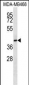 CD200R1 Antibody (C-term)