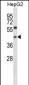 NFYC Antibody (N-term)