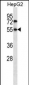 NR4A3 Antibody (C-term)