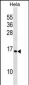 RPS14 Antibody (C-term)