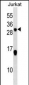 STMN2 Antibody (C-term)