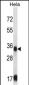 SORD Antibody (Center)