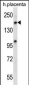 XPO5 Antibody (C-term)