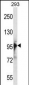 RBM10 Antibody (N-term)