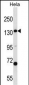 CPS1 Antibody (N-term)