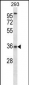 P2RY6 Antibody (C-term)