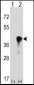 C4BPB Antibody (Center)