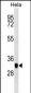 CAPG Antibody (Center)