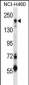 MRC2 Antibody (Center)