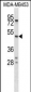 SERPINA5 Antibody (N-term)