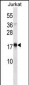 TSLP Antibody (C-term)