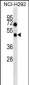 HCRTR1 Antibody (Center)