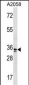 WDR5 Antibody (N-term)