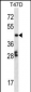 GABPB1 Antibody (C-term)