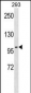 TAX1BP1 Antibody (Center)