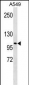 LOXL2 Antibody (C-term)