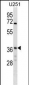 NAPG Antibody (Center)