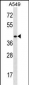 HOXD11 Antibody (Center)