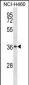 SERPINB1 Antibody (Center)