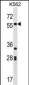 SOX11 Antibody (N-term)