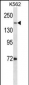 TOP2A Antibody (C-term)