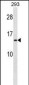 RPS20 Antibody (N-term)