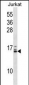 HIST1H2BB/HIST1H2BE Antibody (N-term)