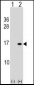 HIST1H2BB/HIST1H2BE Antibody (N-term)