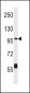 CPT1C Antibody (C-term)