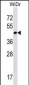 THAP11 Antibody (N-term)