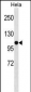 SFRS8 Antibody (N-term)