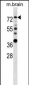 ESR1 Antibody