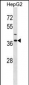 IGBP1 Antibody (Center)