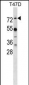 MX1 Antibody (Center)