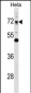 EPN1 Antibody (Center)