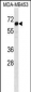 STEAP3 Antibody (C-term)