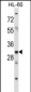 HOXB9 Antibody (Center)