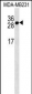 TNFRSF17 Antibody (Center)