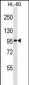 GTF3C2 Antibody (N-term)