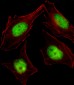 CBFA2T2 Antibody (N-term)