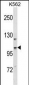 CC2D1A Antibody (N-term)