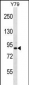 THOC1 Antibody (C-term)