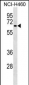 DCT Antibody (Center)