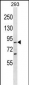 SPG20 Antibody (C-term)