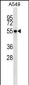 STK17B Antibody (C-term)