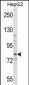 SMO Antibody (Center)