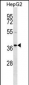 RALY Antibody (Center)