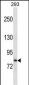 SLC39A6 Antibody (Center)