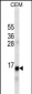 INS Antibody (Ascites)