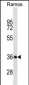 MS4A1/CD20 Antibody (C-term) (Ascites)